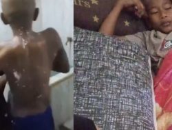 Santri di Aceh Barat diduga Disiram Air Cabai oleh Istri Pimpinan Ponpes